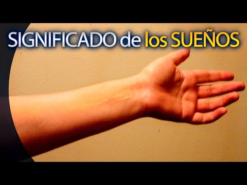 Descubre el significado de soñar que una persona pierde un brazo Descubre el significado de soñar que una persona pierde un brazo