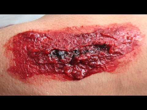 Descubre qué significa soñar con herida en la pierna Descubre qué significa soñar con herida en la pierna