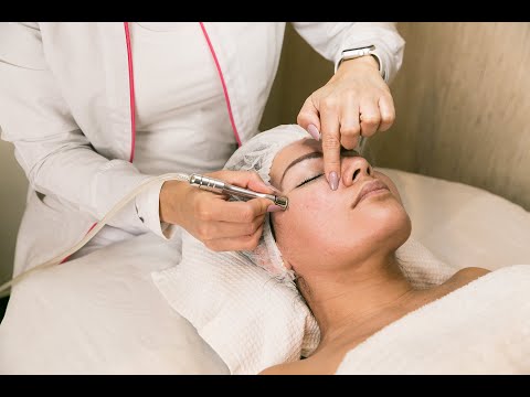 Transformación facial: resultados de la limpieza con punta de diamante antes y después Transformación facial: resultados de la limpieza con punta de diamante antes y después