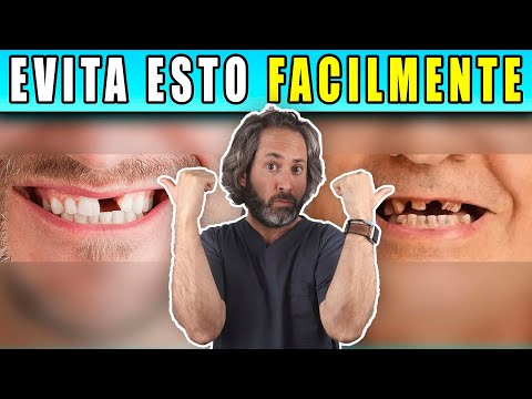 Descubre por qué se estrellan los dientes y cómo prevenirlo Descubre por qué se estrellan los dientes y cómo prevenirlo