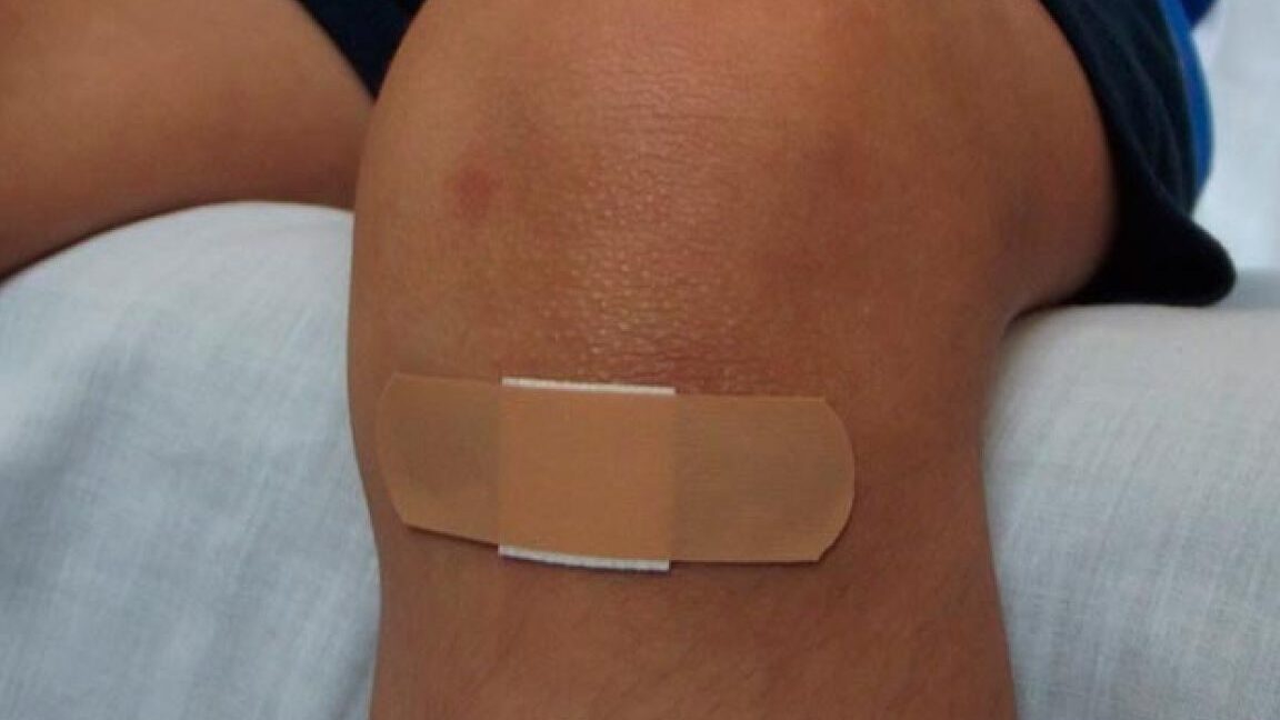 Descubre qué significa soñar con herida en la pierna 1 Descubre qué significa soñar con herida en la pierna