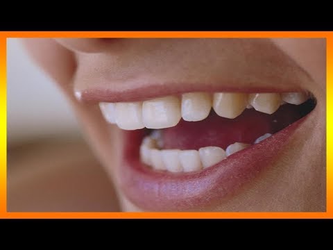 Descubre el impactante significado de soñar con muelas rotas Descubre el impactante significado de soñar con muelas rotas